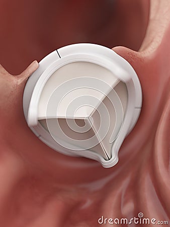 An artificial heart valve Cartoon Illustration