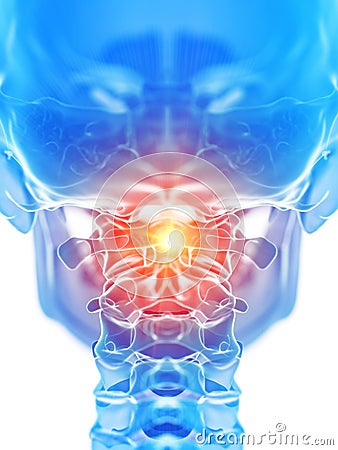 The atlas bone showing pain Cartoon Illustration