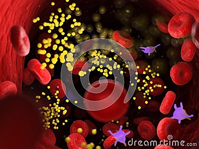 Bacterias in an artery Cartoon Illustration