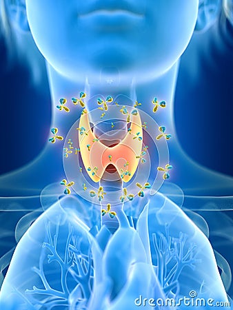 A females thyroid gland being attacked by antibodies Cartoon Illustration