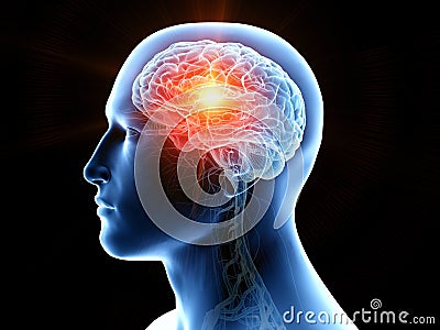 Human brain cancer Cartoon Illustration