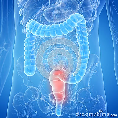 An inflamed rectum Cartoon Illustration