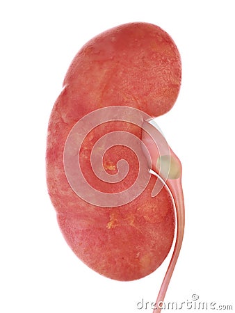 A kidney stone Cartoon Illustration