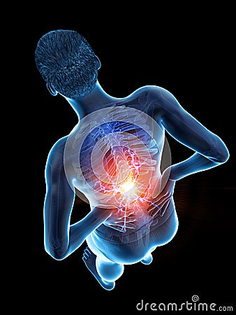 A man having acute back pain Cartoon Illustration