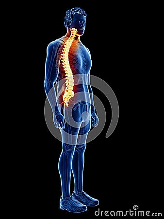 A man having back pain Cartoon Illustration