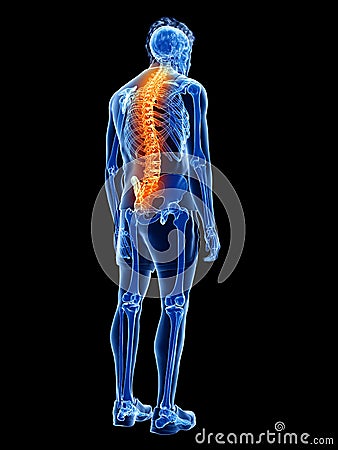 A man having back pain Cartoon Illustration