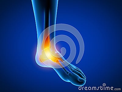 3d rendered medically accurate illustration of a man having a painful foot Cartoon Illustration