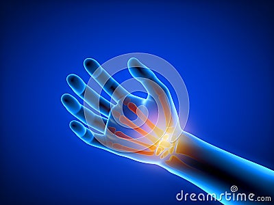 3d rendered medically accurate illustration of a man having a painful hand Cartoon Illustration