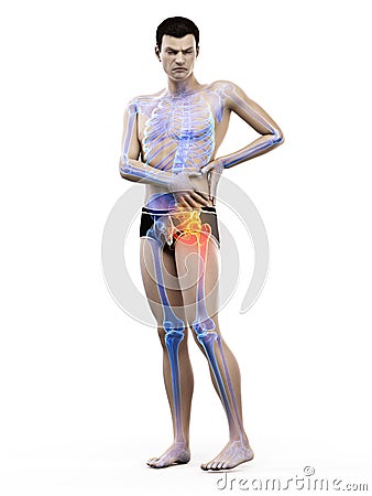 Painful hip joint Cartoon Illustration