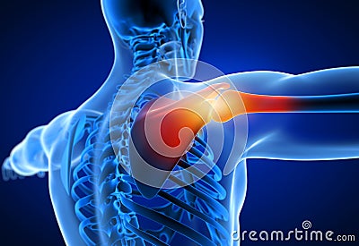 3d rendered medically accurate illustration of a man having a painful shoulder Cartoon Illustration
