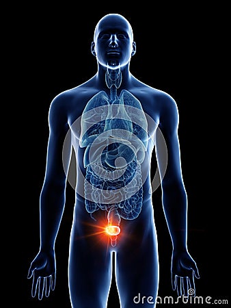 A mans bladder cancer Cartoon Illustration