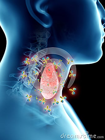 A mans thyroid gland being attacked by antibodies Cartoon Illustration