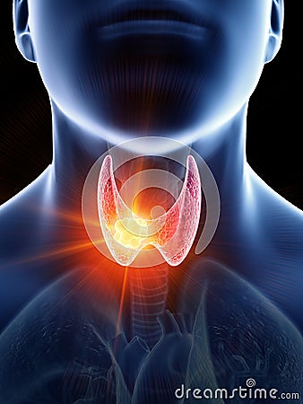 a mans thyroid gland cancer Cartoon Illustration