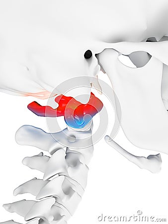 A painful atlas bone Cartoon Illustration