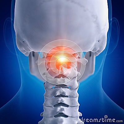 A painful atlas vertebrae Cartoon Illustration