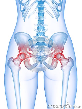 a painful hip joint Cartoon Illustration