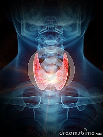 A painful thyroid gland Cartoon Illustration