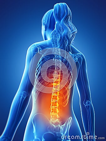 A woman having a painful back Cartoon Illustration