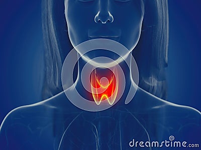 A womans thyroid gland Cartoon Illustration