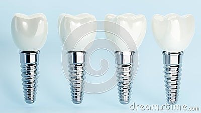 3D rendering of dental implant structure, medical teeth implant, design of dentistry, implant screw, healthcare, dentist and Stock Photo