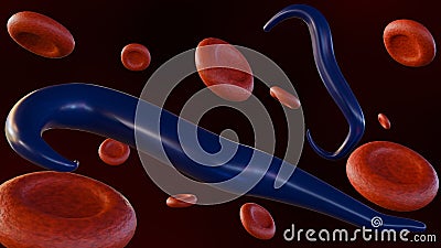 Plasmodium falciparum infected red blood cells Stock Photo