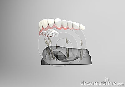 3D rendering teeth Stock Photo