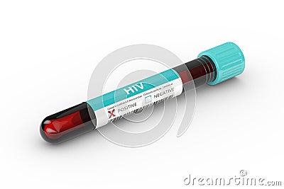 3D rendering of test tube with HIV virus blood sample Stock Photo