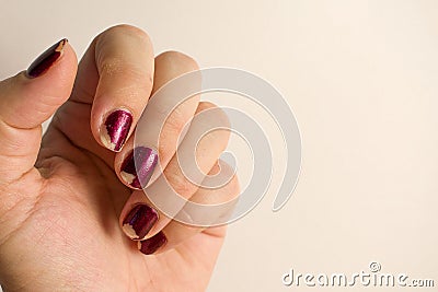 Damaged female manicure. Home manicure in quarantine. Stock Photo