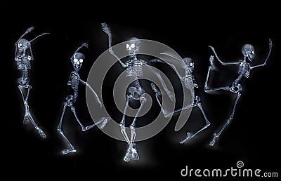 Dancing Skeletons X ray Stock Photo