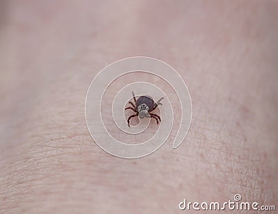 dangerous contagious insect intensity a tick crawling on human skin Stock Photo