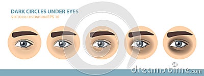 Dark Circles Under Eyes. Male Eye. Vector Illustration Vector Illustration