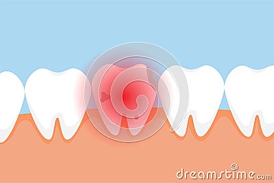 Dead tooth hurting and giving a red pain signal concept. A bad tooth with cavities and a red danger signal. Dental infographic Vector Illustration