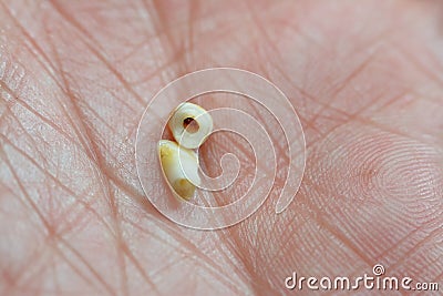 Deciduous primary baby temporary teeth, the first set of teeth in the growth and development of humans, They are usually lost and Stock Photo