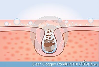 Deep cleaning unclog pores. Vector Illustration