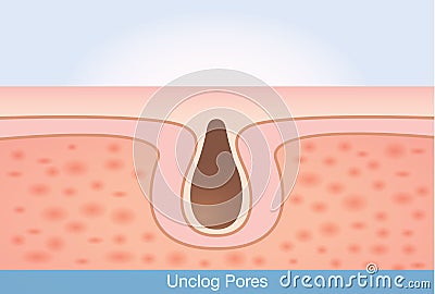 Deep unclog pores. Vector Illustration