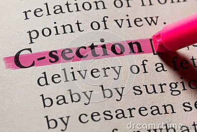 Definition of C-section Stock Photo