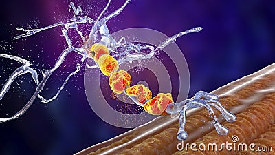 Degradation of motor neurons, conceptual 3D illustration Cartoon Illustration