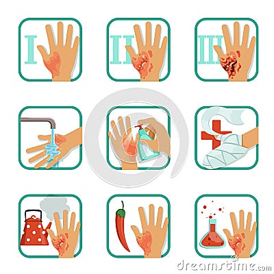 Degree burns set, burns treatment and classification vector Illustrations Vector Illustration