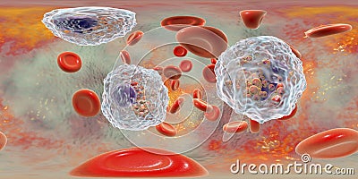 360-degree spherical panorama of blood with eosinophilia Cartoon Illustration