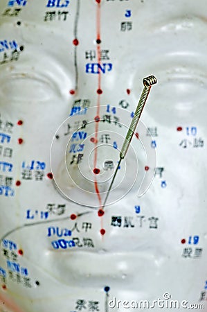 Acupuncture needle on head model Stock Photo