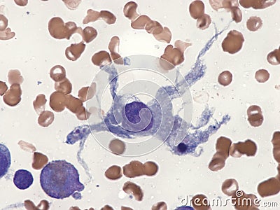 Dendritic cell in bone marrow. Stock Photo
