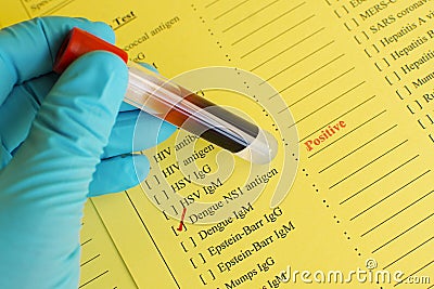 Dengue positive Stock Photo