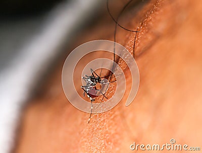 Dengue zika chikungunya fever mosquito aedes aegypti on human skin Stock Photo