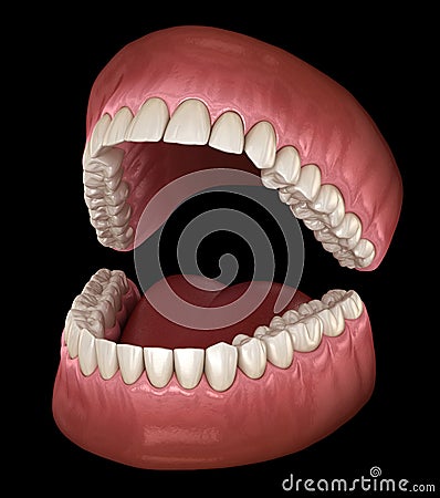 Dental anatomy - Opened Dentures. Medically accurate dental Cartoon Illustration