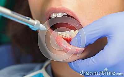 Dental anesthesia Stock Photo