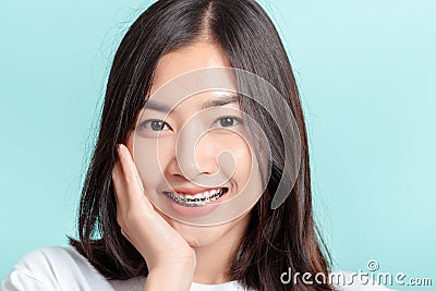Dental braces of young asian woman wearing braces beauty smile with white teeth Stock Photo