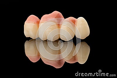 Dental bridge of 4 teeth on artificial gums. Close-up photo of ceramic teeth crown isolated on black glass background Stock Photo