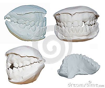 Dental cast Stock Photo