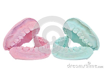 Dental casting gypsum model plaster cast stomatologic Stock Photo