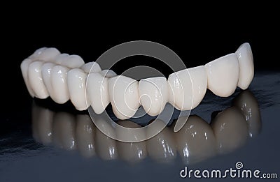 Dental bridge Stock Photo